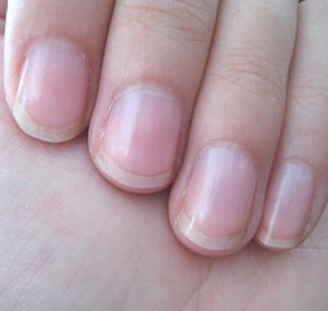 Normal Fingernails Look Like